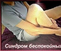 Restless legs syndrome causes and treatment
